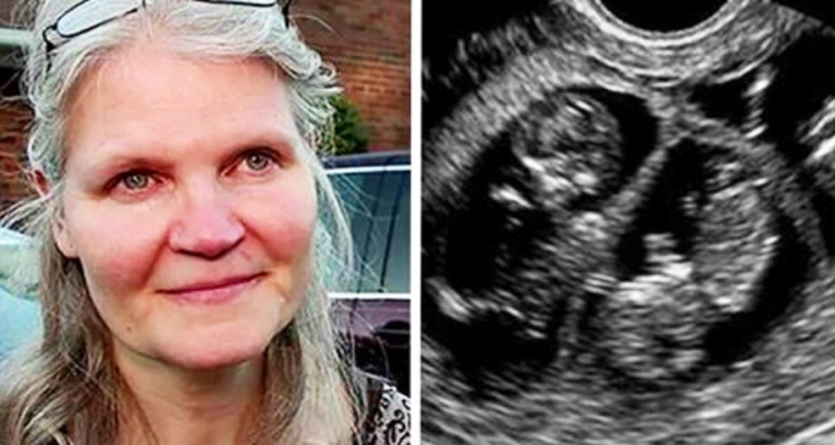 Женщина в 42 забеременела тройняшками, но во время родов случилось непредвиденное!
